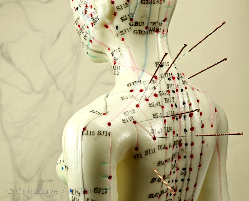 acupuncture, model, needle